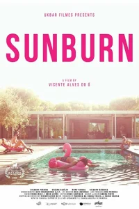 Солнечный ожог